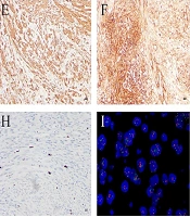 Unexpected Diagnosis of Uterine Inflammatory Myofibroblastic Tumor During Cesarean Section