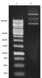 Construction and Structural Assessment of Nanocapsule Containing HER2-MUC1 Chimeric Protein as a Candidate for a Vaccine Against Breast Cancer