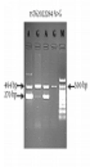 Characterization of Novel Non-Synonymous Genomic Variants Altering Drug Response of DNA Topoisomerase II Alpha