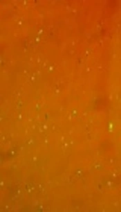 Cover image of the article: Myeloid Cell Leukemia-1 (MCL-1) siRNA Therapy Showed Cytotoxic Effect on T Cells Acute Lymphoblastic Leukemia