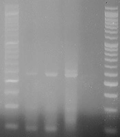 The Prevalence and Association of Human Papillomavirus with Esophageal Cancer in West Azerbaijan, Iran