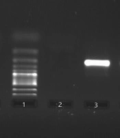 The Prevalence of Human Herpes Virus Type 8 in Semen Specimens of HIV-Negative Iranian Population Detected by Nested Polymerase Chain Reaction