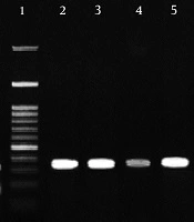 Evaluation of Leptin Receptor Q223R (rs1137101) Polymorphism Based on Histopathological and Body Mass Index Characteristics in Iranian Females with Breast Cancer
