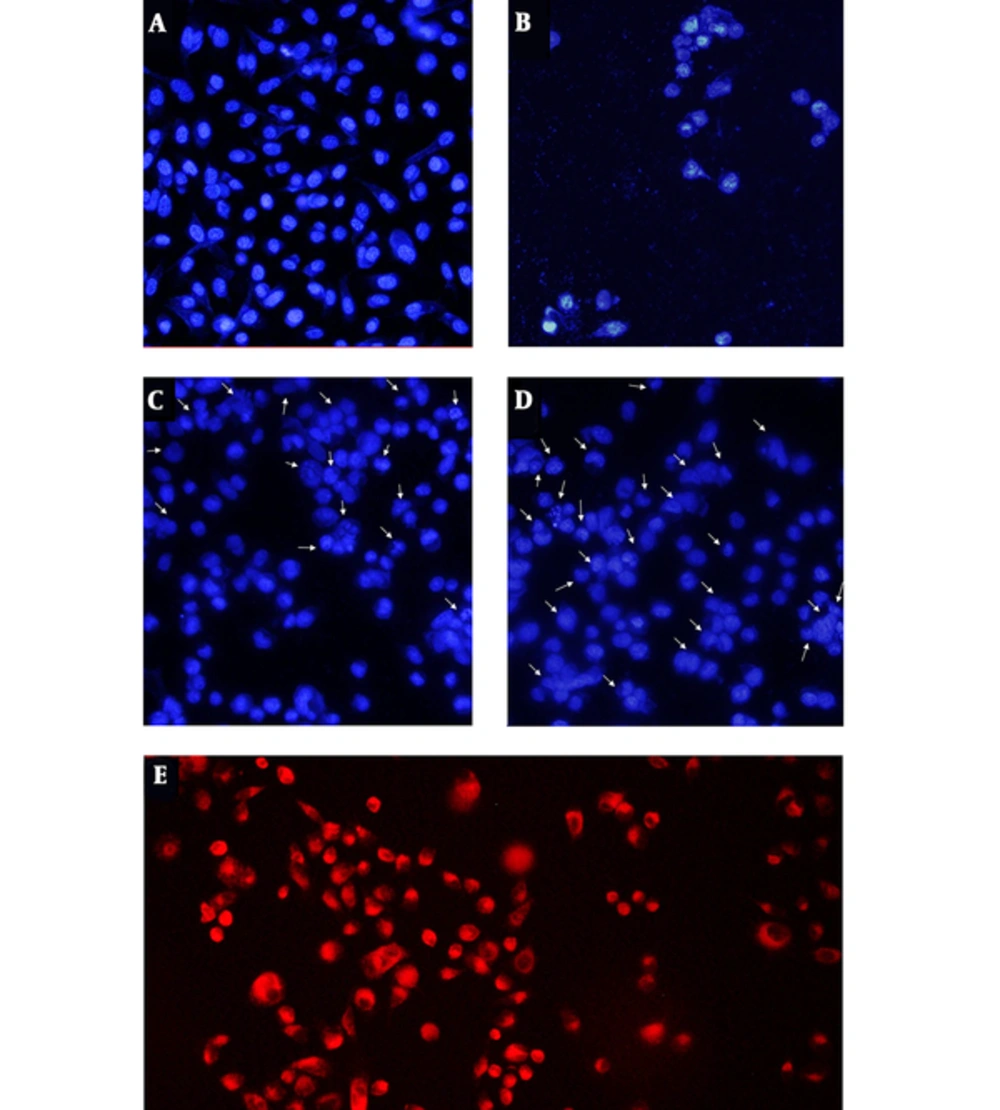 Fluorescent images of DAPI stained PC3 cells following a 48 hour exposure by <b>(A)</b> untreated, <b>(B)</b> DMSO 5%, <b>(C)</b> 61 µM EA and, <b>(D)</b> 61 µM EA-loaded SLNs. <b>(E)</b> Fluorescence microscope images of Rhodamine B-loaded SLNs uptake. (The arrows show nuclear condensation) Fluorescent images of DAPI stained PC3 cells following a 48 hour exposure by <b>(A)</b> untreated, <b>(B)</b> DMSO 5%, <b>(C)</b> 61 µM EA and, <b>(D)</b> 61 µM EA-loaded SLNs. <b>(E)</b> Fluorescence microscope images of Rhodamine B-loaded SLNs uptake. (The arrows show nuclear condensation)