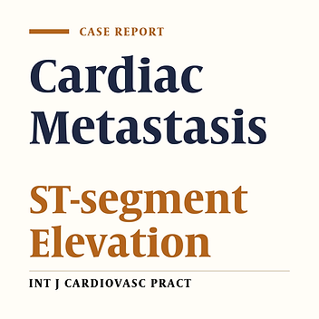 ST-Segment elevation: Not always