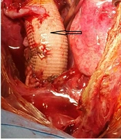 Int J Cardiovasc Pract