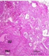 Maternal Exposure to D-galactose Reduces Ovarian Reserve in Female Rat Offspring Later in Life