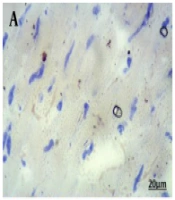 The G-Protein-Coupled Estrogen Receptor Agonist Prevents Cardiac Lipid Accumulation by Stimulating Cardiac Peroxisome Proliferator-Activated Receptor α: A Preclinical Study in Ovariectomized-Diabetic Rat Model