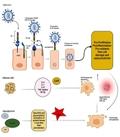Diabetes Ketoacidosis and COVID-19: An Insight into the Pathophysiology
