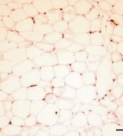 Sphingosine Kinase 2 Knockout Mice Resist HFD-Induced Obesity Through Increasing Energy Expenditure