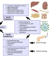 Type 1 Diabetes and COVID-19: A Literature Review and Possible Management