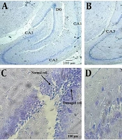 Disturbed Spatial Learning and Hippocampal Molecular and Histological Alterations in Middle-Aged Rats with a History of Polycystic Ovary Syndrome