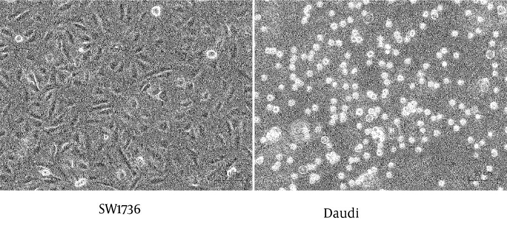 SW1736 Cell and Daudi Cells Before Co-culture SW1736 Cell and Daudi Cells Before Co-culture
