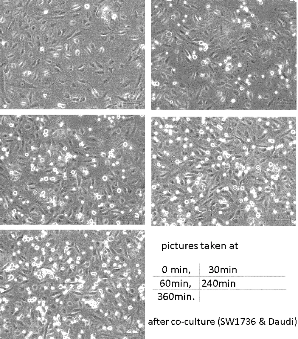 Co-cultured Daudi and SW1736 Cell Lines Co-cultured Daudi and SW1736 Cell Lines