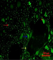 Cover image of the article: Vitamin D Inhibition of TRPV5 Expression During Osteoclast Differentiation