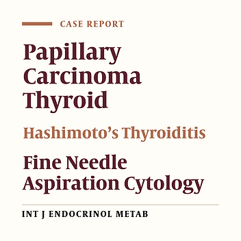 Coexistent Papillary Carcinoma of Thyroid and Hashimoto’s Thyroiditis – Diagnosis on Fine Needle Aspiration Cytology