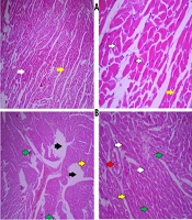 Cover image of the article: Examining the Cardioprotective Effects of Aerobic Exercise Combined with Crocin or Berberine on Methamphetamine-Induced Heart Damage in Female Rats