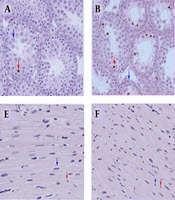 Protective Effects of Vitamin E on Heart and Testis Histology Following MDMA (Ecstasy) Exposure in Mice