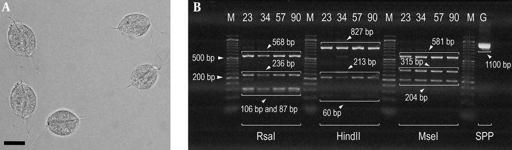 A, <i>T. vaginalis</i> trophozoites detected in urine specimens of symptomatic patients in the current study (bars showing 15 μm); B, Gel electrophoresis of DNA fragments obtained after digesting by PCR-RFLP. Lanes 23, 34, 57, and 90 show the banding patterns after digestion with <i>Rsa</i>I, <i>Hind</i>II, and <i>Mse</i>I (GenBank Accession no. AB468096 and AB4698092); lane M is a 50-bp DNA ladder; lane G (SSP) is the amplified actin gene with size 1100 bp (secondary PCR product). A, <i>T. vaginalis</i> trophozoites detected in urine specimens of symptomatic patients in the current study (bars showing 15 μm); B, Gel electrophoresis of DNA fragments obtained after digesting by PCR-RFLP. Lanes 23, 34, 57, and 90 show the banding patterns after digestion with <i>Rsa</i>I, <i>Hind</i>II, and <i>Mse</i>I (GenBank Accession no. AB468096 and AB4698092); lane M is a 50-bp DNA ladder; lane G (SSP) is the amplified actin gene with size 1100 bp (secondary PCR product).