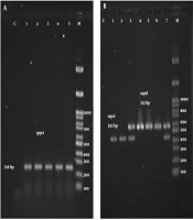 Cover image of the article: Detection of OqxAB and QepA Efflux Pumps and Their Association with Antibiotic Resistance in Klebsiella pneumoniae Isolated From Urinary Tract Infection