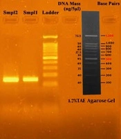 Response of Group B Streptococcus to the Combination of Gold Nanoparticles-Erythromycin as a Nanoweapon