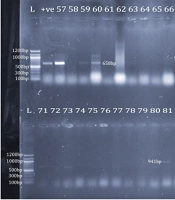 Low Occurrence of Virulence Determinants in Vancomycin-Resistant Enterococcus from Clinical Samples in Southwest Nigeria