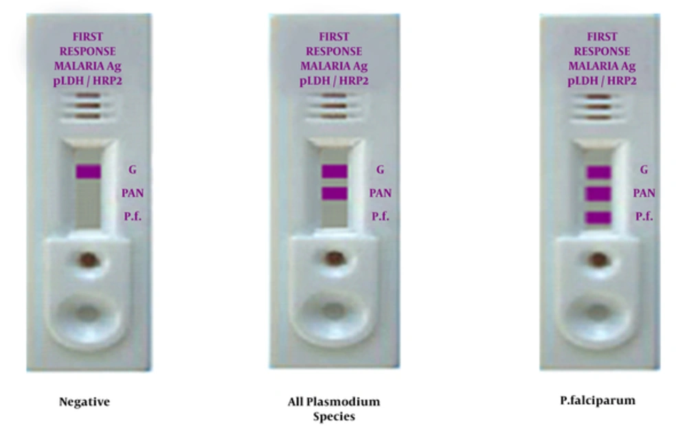 RDT Test for Determination of Malaria Infection to Malaria Suspected Patients in Saravan Health Center RDT Test for Determination of Malaria Infection to Malaria Suspected Patients in Saravan Health Center