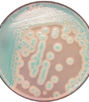 Detection of ERG11 Transcripts in Fluconazole-Resistant Candida albicans Isolates from Patients with Mucosal Candidiasis in Zahedan, Iran: A Cross-sectional Laboratory Study