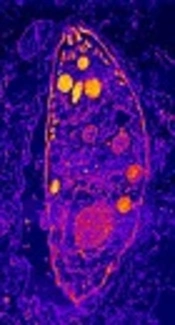 Toxoplasma gondii: Are There any Implications for Routine Blood Screening?