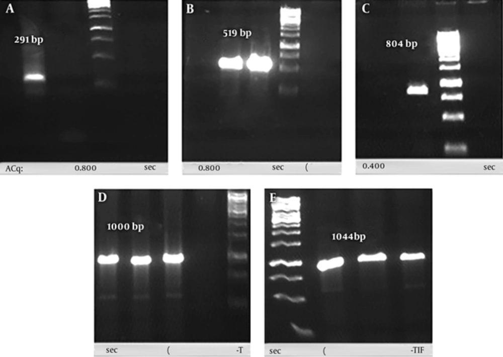 A, PCR products of 3 repeatation of OMP31 epitope; B, PCR products of IL-2; C, PCR products of rCIL2-3E using SOE-PCR procedure; D, conformation of inserting the rCIL2-3E into PTZ vector through colony-PCR process using M13 universal primer; E, conformation of inserting the rCIL2-3E into pET-22b (+) vector through colony-PCR process using T7 universal primer A, PCR products of 3 repeatation of OMP31 epitope; B, PCR products of IL-2; C, PCR products of rCIL2-3E using SOE-PCR procedure; D, conformation of inserting the rCIL2-3E into PTZ vector through colony-PCR process using M13 universal primer; E, conformation of inserting the rCIL2-3E into pET-22b (+) vector through colony-PCR process using T7 universal primer