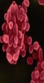 Brucella melitensis,  Kenyon College