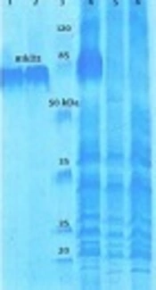 Production and Purification of Specific IgY Against InvG Protein of Salmonella typhimurium