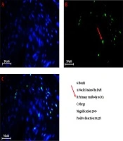 Endoscopic Injection of Bulking Agents for the Treatment of Vesicoureteral Reflux and Introducing a New Material: Acellular Lyophilized Prepuce as a Natural Scaffold