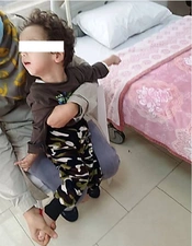 Triosephosphate Isomerase Deficiency: The First Case Report from I.R. Iran
