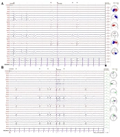 Innov J Pediatr