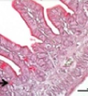 Effects of Hesperidin and Diosmin on Necrotizing Enterocolitis: An Experimental Study