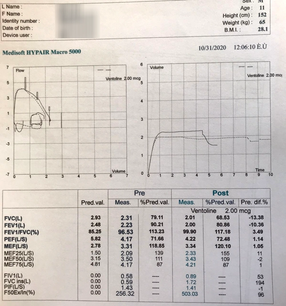 Spirometry of the patient with an extra-thoracic obstructive pattern Spirometry of the patient with an extra-thoracic obstructive pattern