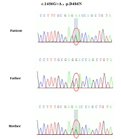 Cover image of the article: Novel Compound Heterozygous Mutations of the SLC12A3 Gene in Gitelman Syndrome with Growth Hormone Deficiency and Hypothyroidism