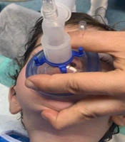 Comparison of Facemask Ventilation Quality Between the Three-Finger Grip and the Three-Finger Grip Plus the Newly-Devised Submental Maneuver in Infants: A Double-Blind, Randomized Controlled Trial