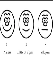 Consolation Effect of Medical Clown Care Model in Children with Inguinal Hernia During Perioperative Period: A Single-Center Study in China