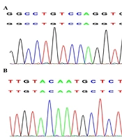 Genetic Insights in 24 Chinese Pediatric Patients with Difficult-to-Diagnose Respiratory Diseases