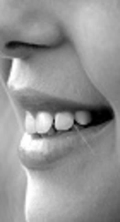 A Comparison of the Prevalence of Dental Enamel Defects and Other Oral Findings in Children with and without Celiac Disease