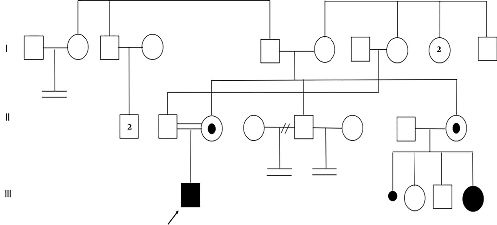 Pedigree of the family Pedigree of the family