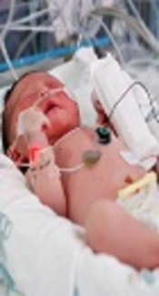 Rescue High-Frequency Oscillatory Ventilation in Neonatal Respiratory Failure Unresponsive to Conventional Mechanical Ventilation