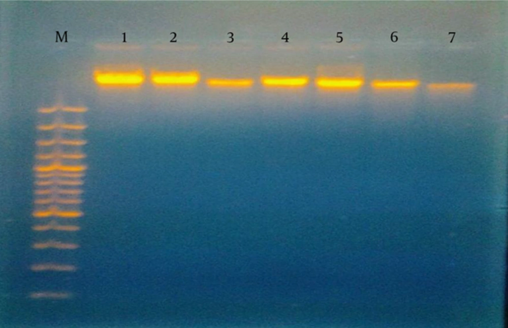 DNA Pattern After Gel Electrophoresis M, 100 bp DNA ladder, lanes 1, 2, 4, and 5 show normal DNA patterns; lanes 3, 6, and 7 show hazy fragmented DNA.