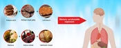Determining the Levels of Acrylamide in Some Traditional Foods Unique to Turkey and Risk Assessment