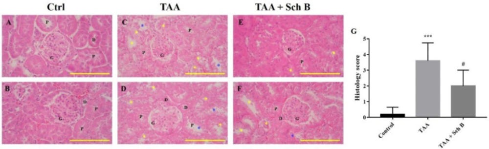 Histopathology of the kidney. (A and B) Two representative photomicrographs of H&E-stained kidney sections from control mice. (C and D) Kidney sections from TAA-injected mice. Degeneration of renal tubular (yellow asterisks) and desquamation (blue asterisks) were seen. (E and F) Kidney sections from TAA-injected mice following Sch B treatment. Fewer tubular degeneration and desquamation were seen. Images are shown at 100× magnifications; scale bars, 200 μm. G, glomeruli; P, proximal convoluted tubules; D, distal convoluted tubules. (G) Histology score of kidney sections, presented as mean ± SD (n = 5). <sup>***</sup><i>P</i>-value < 0.001 compared with control; <sup>#</sup><i>P</i>-value < 0.05 compared with TAA