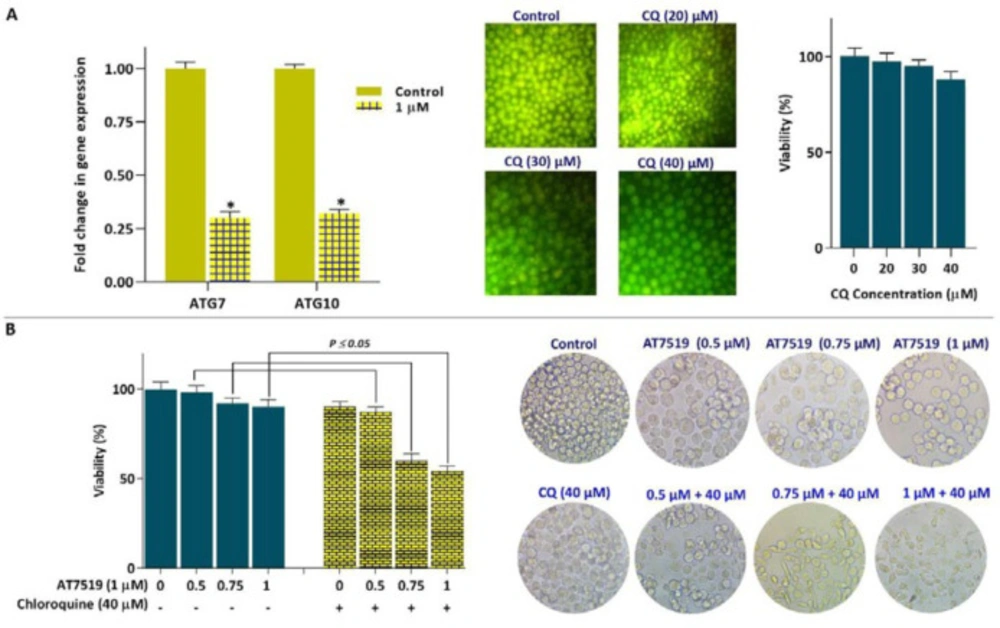 Co-treatment of AT7519 and autophagy inhibitor CQ led to superior cytotoxicity in KG-1 cells. (A) Inhibition of CDK using AT7519 down-regulated the mRNA expressions of both ATG7 and ATG10 in KG-1 cells. (B) CQ reinforced the anti-cancer impact of AT7519 in KG-1 cells. Values are given as mean ± SD of three independent experiments. <sup>*</sup><i>P</i> ≤ 0.05 represents significant changes from untreated control