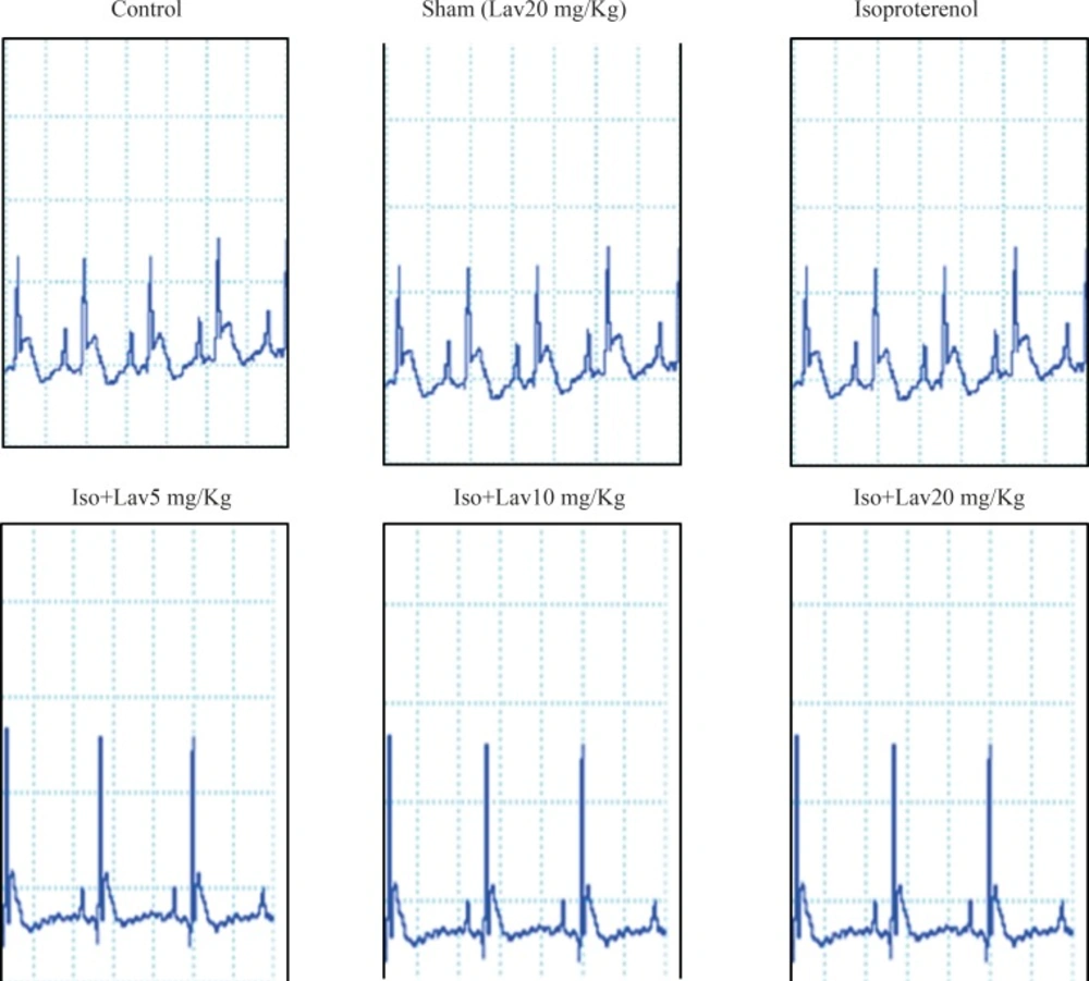 The effects of essential oil of <i>L. angustifolia</i> on electrocardiographic pattern and changes (recorded from limb lead II) in control, isoproterenol and Lavandula groups. Iso: Isoproterenol, Lav: <i>L. angustifolia</i> essential oil.
