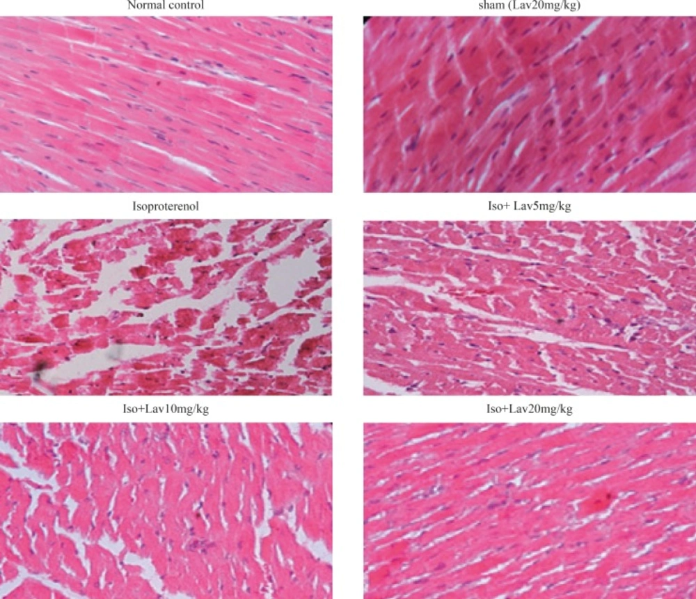 Photomicrographs of sections of rat cardiac apexes. Heart tissue of a rat subcutaneously injected with isoproterenol alone shows intensive cardiomyocyte necrosis and increased edematous intramuscular space. Treatment with <i>L. angustifolia</i> demonstrates a marked improvement. Iso: Isoproterenol. Lav: <i>L. angustifolia</i> (H&E).